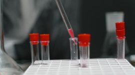 Seorang peneliti memeriksa sampel kayu bajakah di laboratorium, bagian dari upaya ilmiah untuk mengidentifikasi senyawa aktif dan menguji potensi khasiatnya sebagai agen kesehatan alami. Gambar ini menunjukkan dedikasi para ilmuwan dalam mengungkap misteri ramuan tradisional dari hutan tropis Kalimantan.